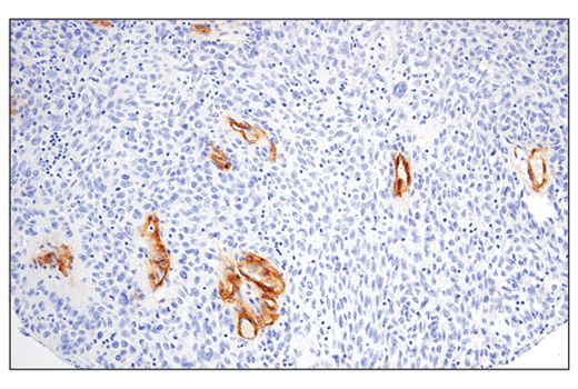 Immunohistochemistry Image 3: IGFBP7 (E3Z8L) XP® Rabbit mAb