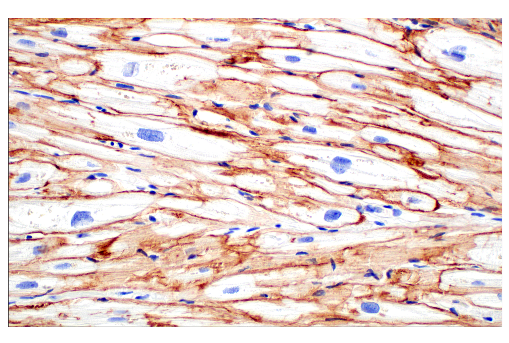 Immunohistochemistry Image 3: Dystrophin (E4F3S) Rabbit mAb