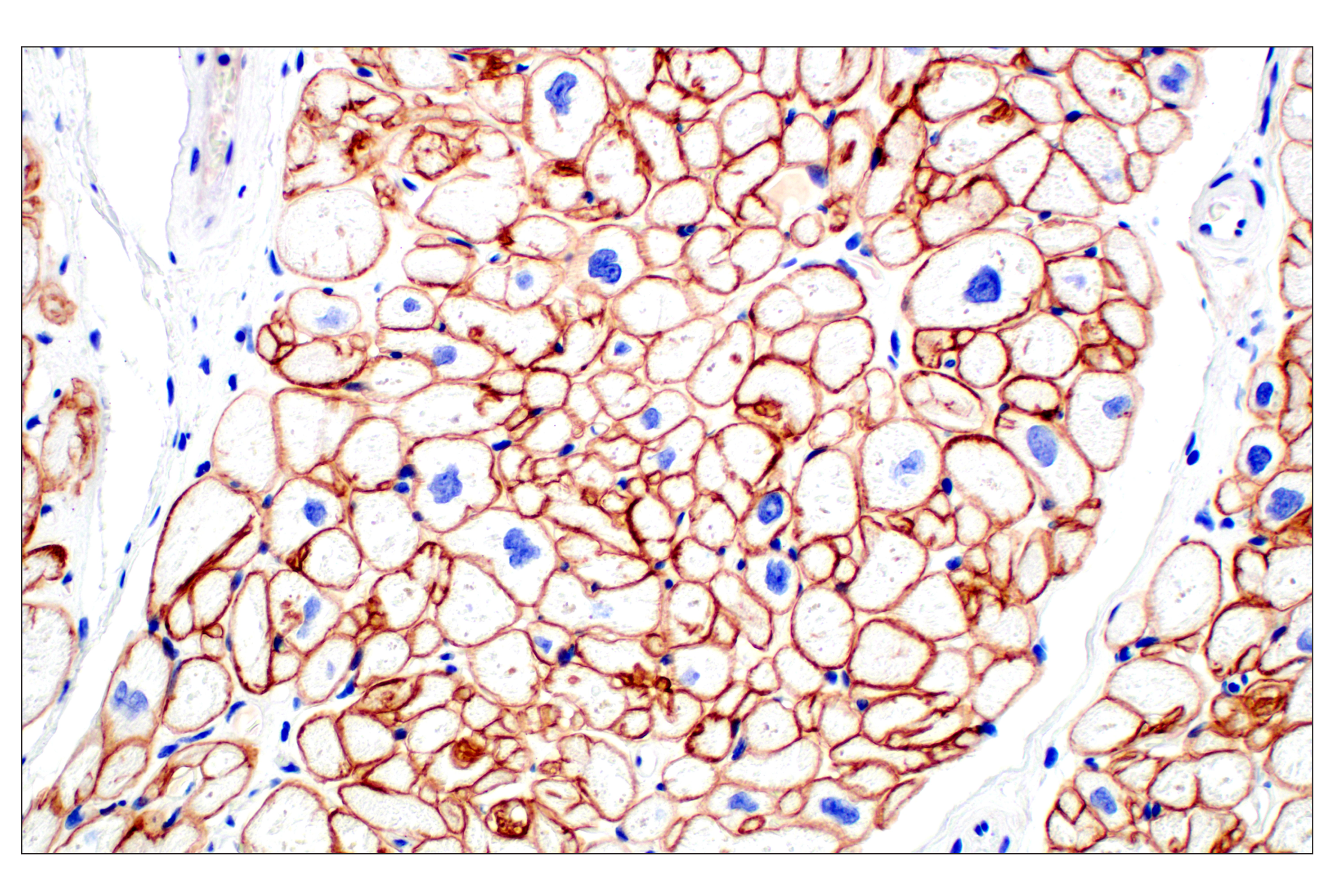 Immunohistochemistry Image 4: Dystrophin (E4F3S) Rabbit mAb