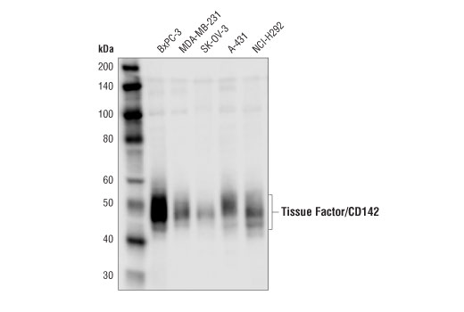 Western Blotting Image 1: Tissue Factor/CD142 Antibody
