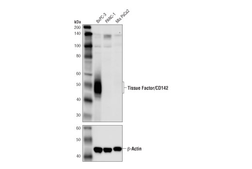 Western Blotting Image 3: Tissue Factor/CD142 Antibody