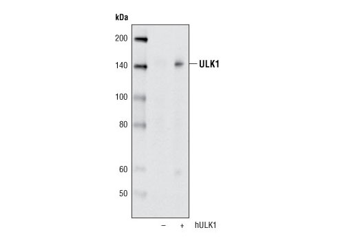 Western Blotting Image 1: ULK1 (A705) Antibody