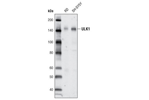 Western Blotting Image 2: ULK1 (A705) Antibody