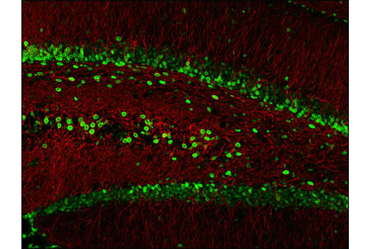 Immunofluorescence Image 1: Lamin A/C (4C11) Mouse mAb
