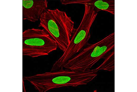 Immunofluorescence Image 2: Lamin A/C (4C11) Mouse mAb