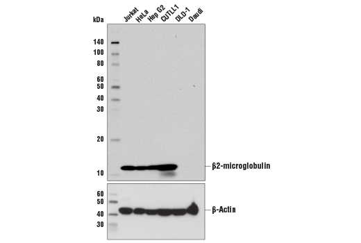 Western Blotting Image 1: β2-microglobulin (D8P1H) Rabbit mAb (BSA and Azide Free)