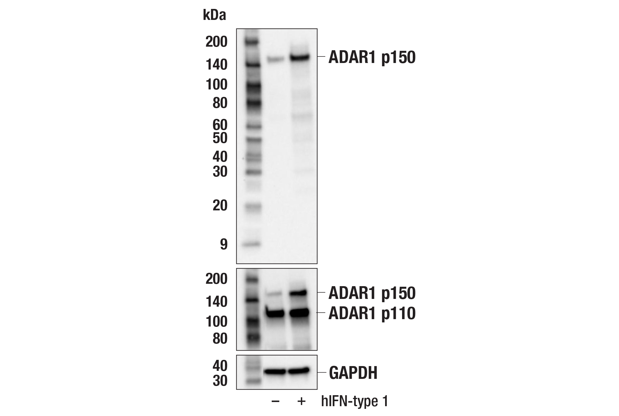 Western Blotting Image 2: ADAR1 p150 Isoform (E6U1U) Rabbit mAb (BSA and Azide Free)