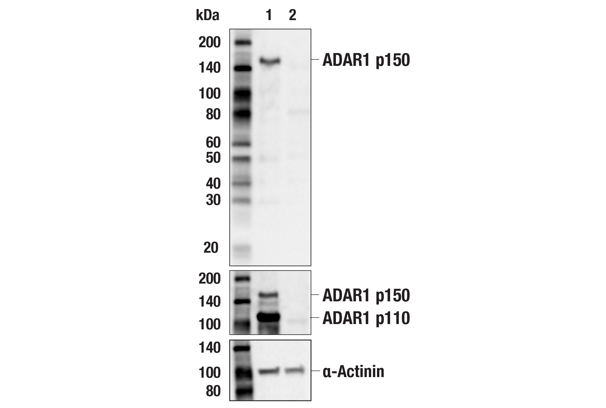 Western Blotting Image 1: ADAR1 p150 Isoform (E6U1U) Rabbit mAb (BSA and Azide Free)