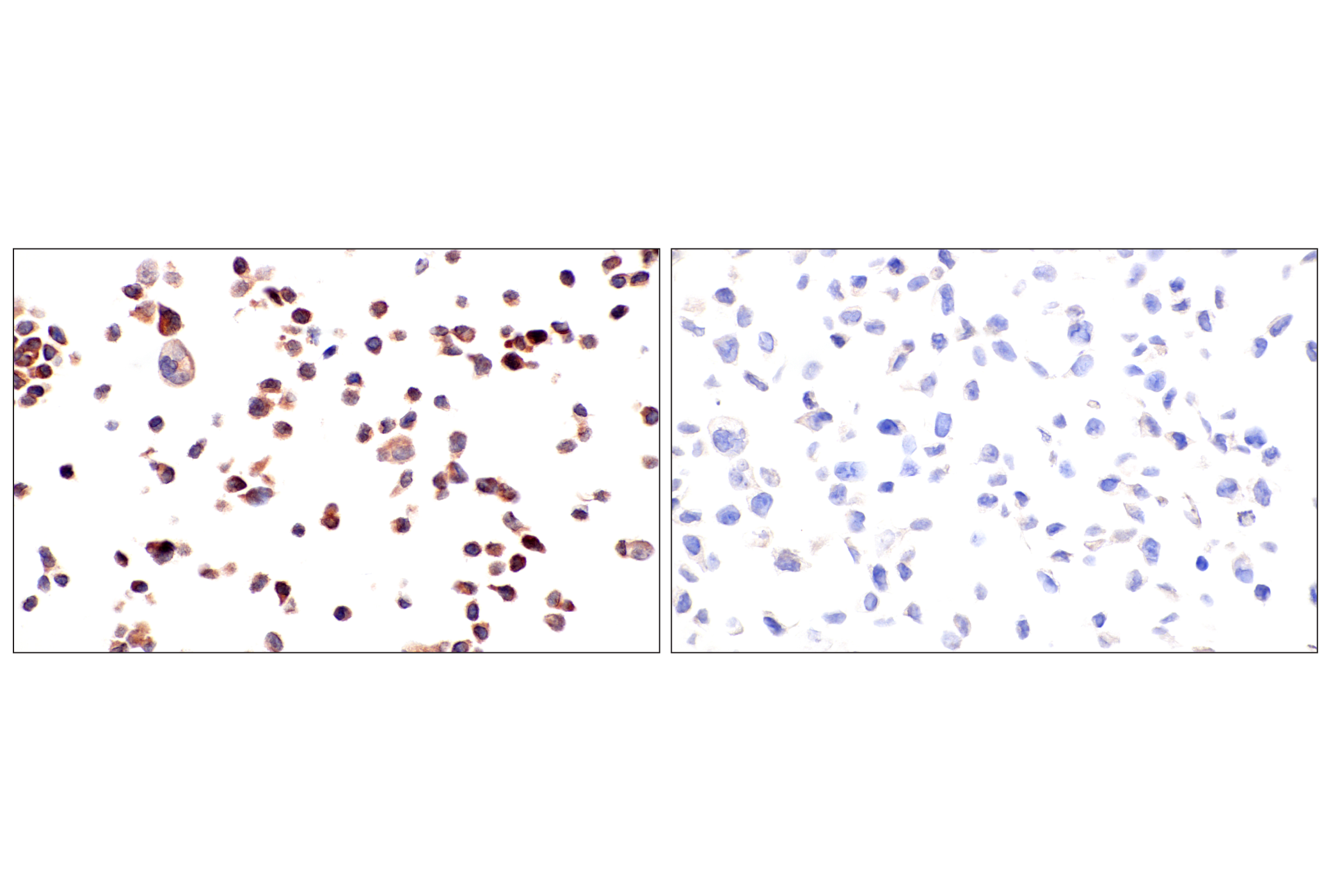 Immunohistochemistry Image 14: ADAR1 p150 Isoform (E6U1U) Rabbit mAb (BSA and Azide Free)