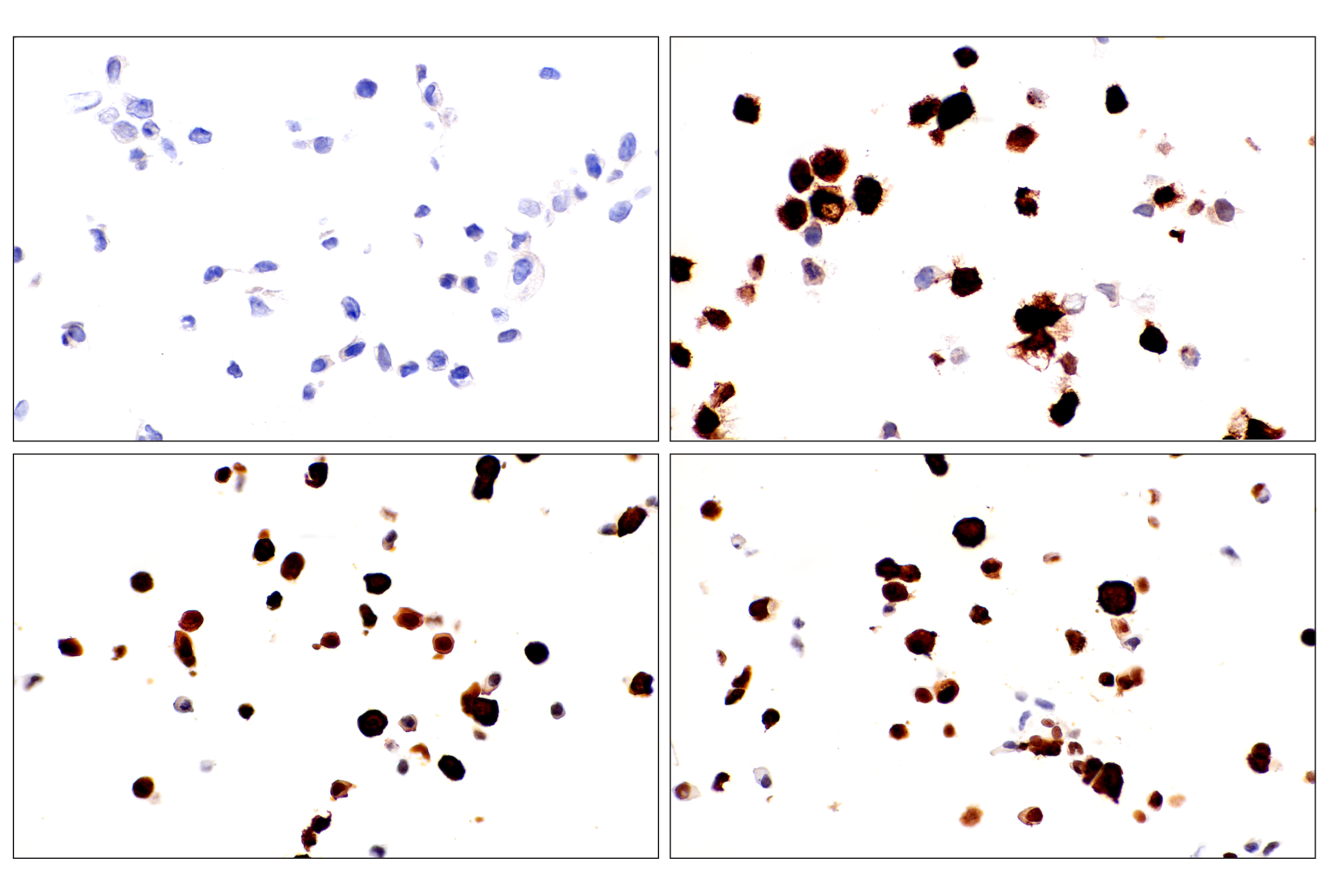 Immunohistochemistry Image 13: ADAR1 p150 Isoform (E6U1U) Rabbit mAb (BSA and Azide Free)