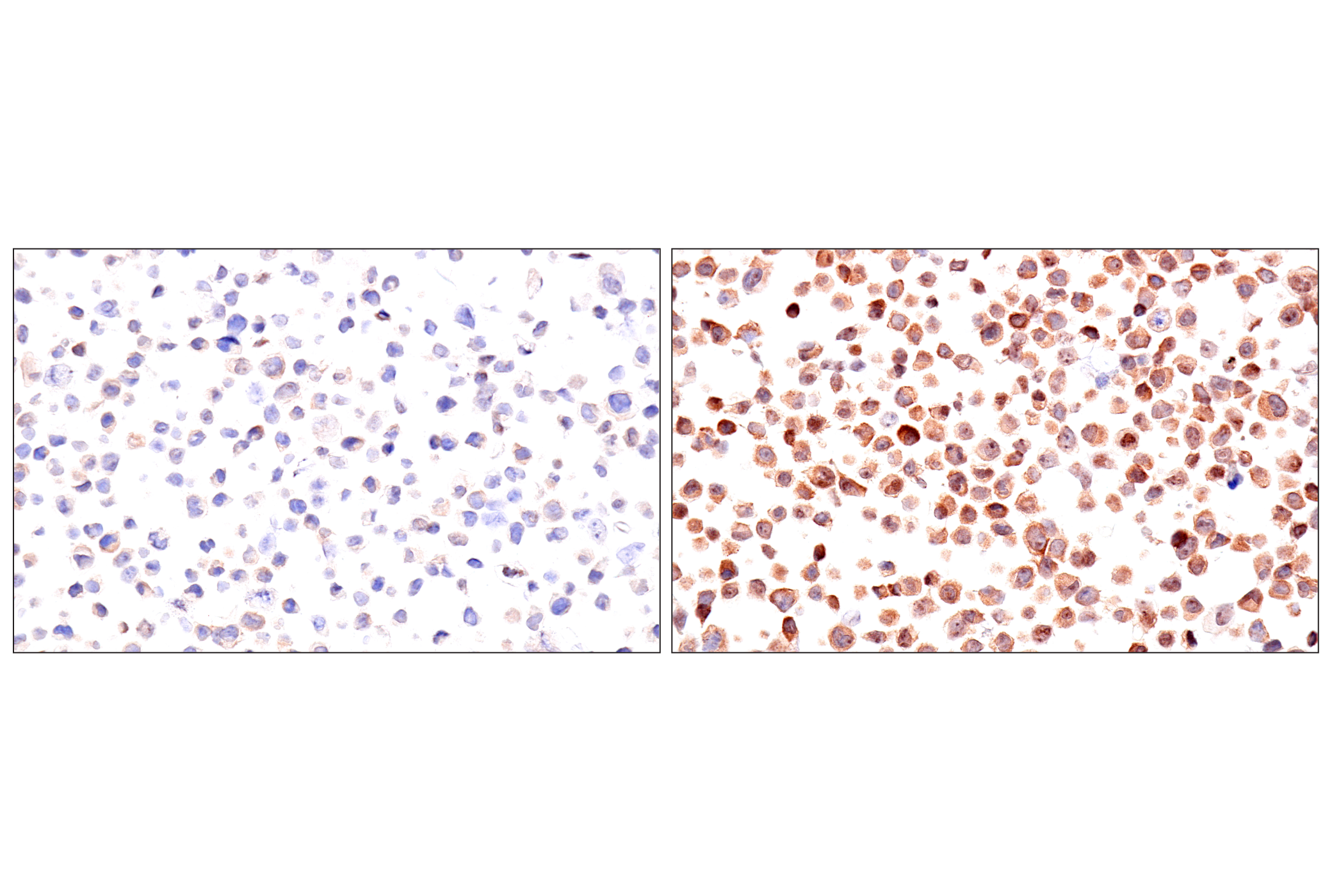 Immunohistochemistry Image 15: ADAR1 p150 Isoform (E6U1U) Rabbit mAb (BSA and Azide Free)