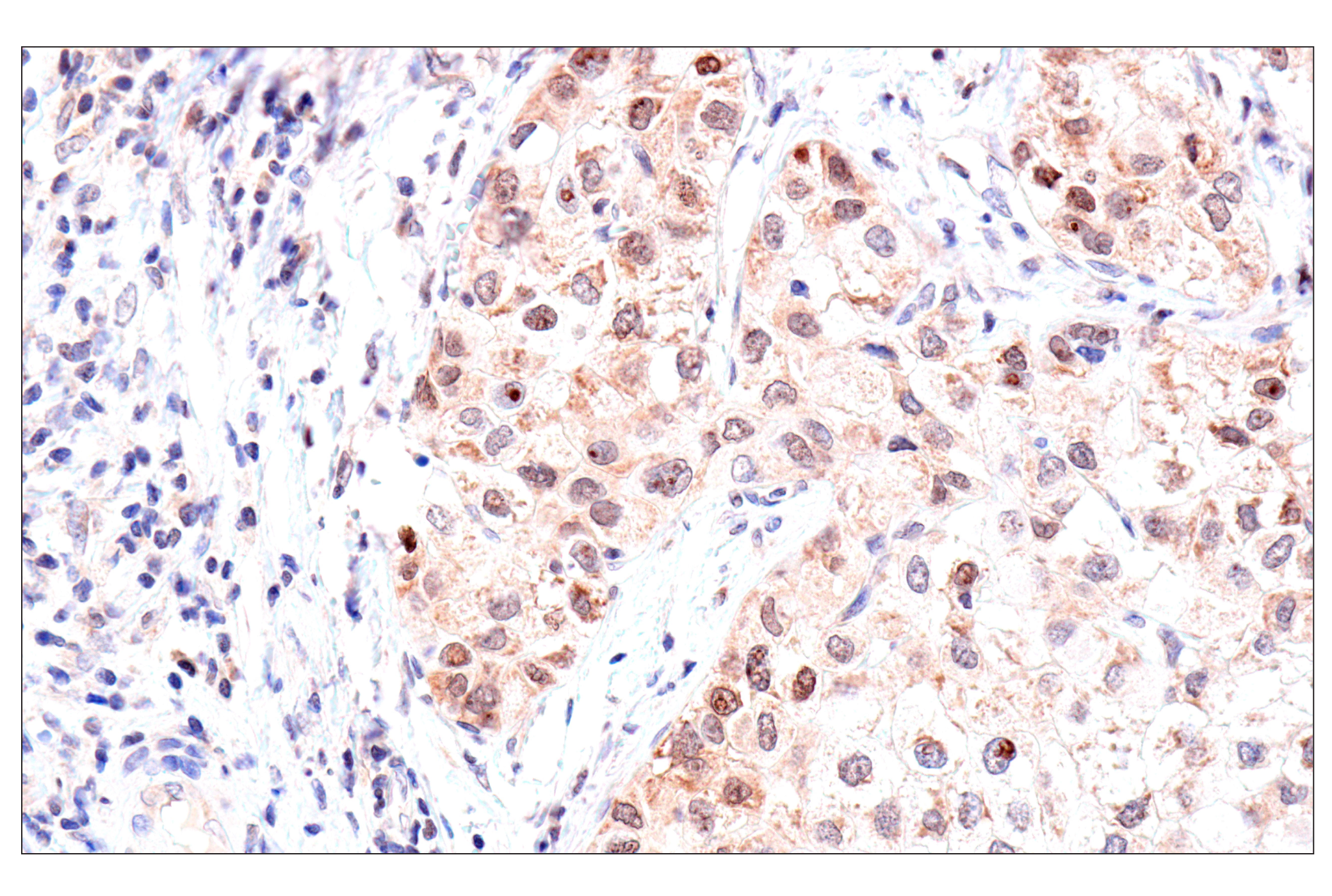 Immunohistochemistry Image 3: ADAR1 p150 Isoform (E6U1U) Rabbit mAb (BSA and Azide Free)
