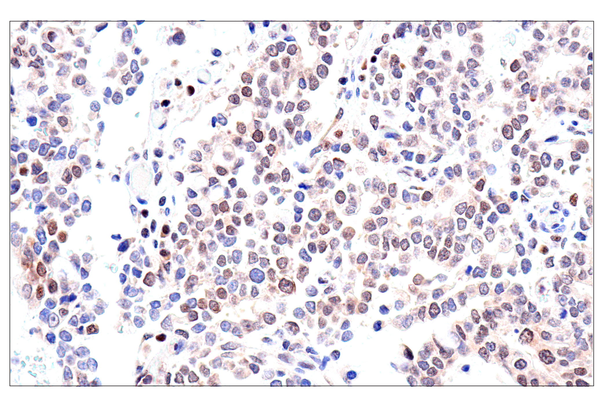 Immunohistochemistry Image 6: ADAR1 p150 Isoform (E6U1U) Rabbit mAb (BSA and Azide Free)