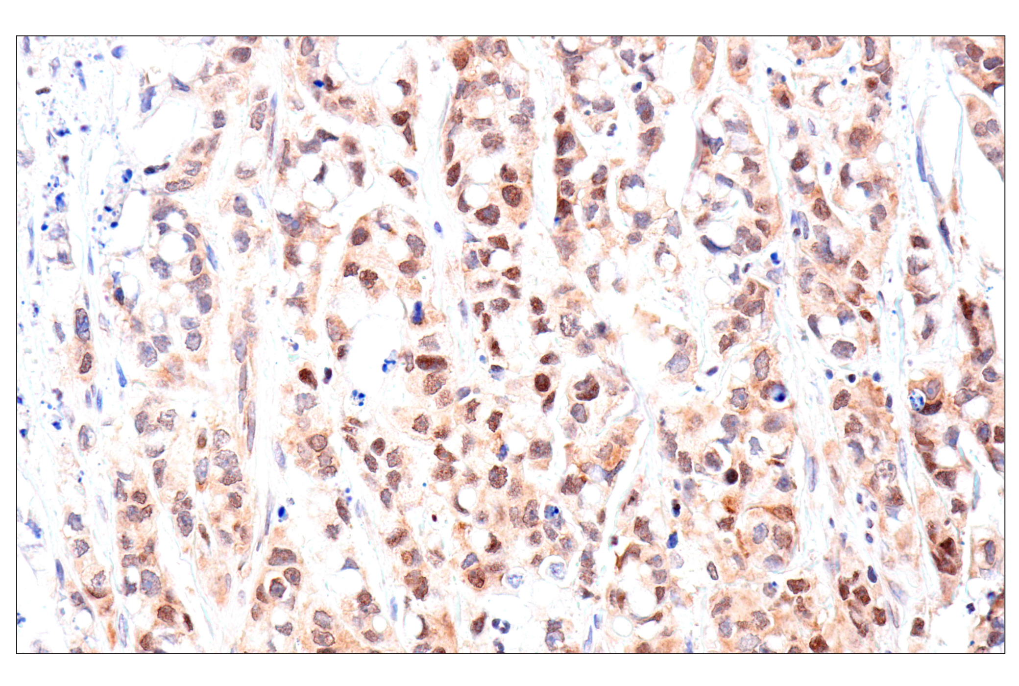 Immunohistochemistry Image 7: ADAR1 p150 Isoform (E6U1U) Rabbit mAb (BSA and Azide Free)
