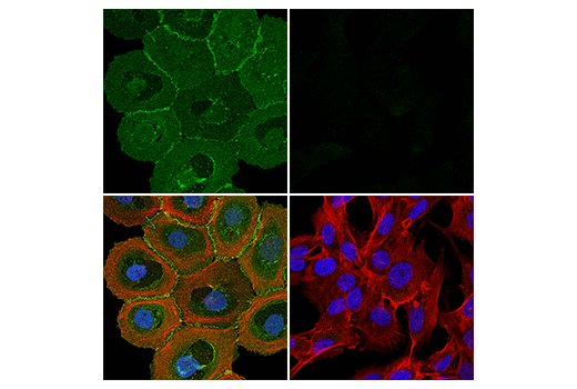 Immunofluorescence Image 1: TACSTD2/TROP2 (E8Y8S) Rabbit mAb