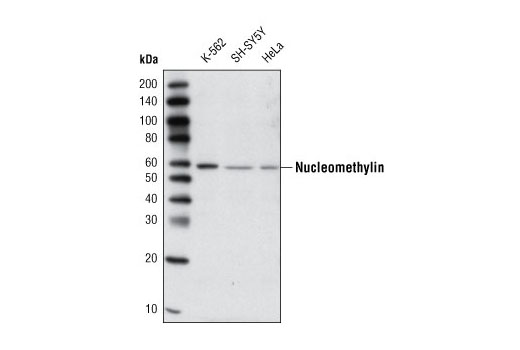 Western Blotting Image 1: Nucleomethylin Antibody