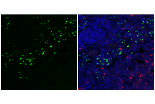 Immunofluorescence Image 1: CD127/IL-7Rα (A7R34) Rat mAb (FITC Conjugate)