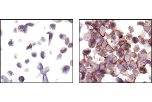 Immunohistochemistry Image 3: Phospho-HER3/ErbB3 (Tyr1289) (21D3) Rabbit mAb