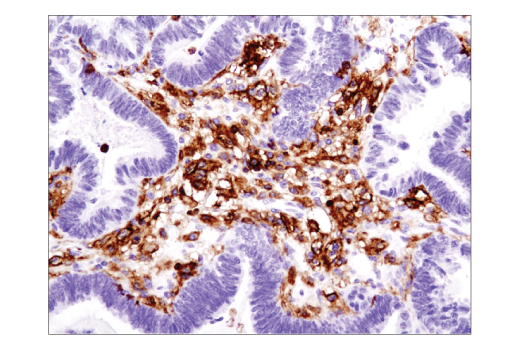 Immunohistochemistry Image 3: CD45 (Intracellular Domain) (D9M8I) XP® Rabbit mAb (BSA and Azide Free)