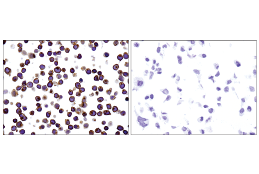 Immunohistochemistry Image 4: CD45 (Intracellular Domain) (D9M8I) XP® Rabbit mAb (BSA and Azide Free)