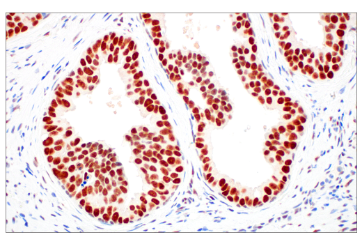 Immunohistochemistry Image 1: MLH1 (ES05) Mouse mAb