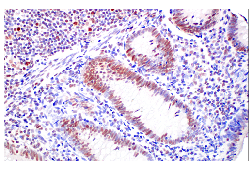 Immunohistochemistry Image 7: MLH1 (ES05) Mouse mAb