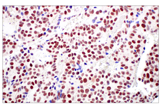 Immunohistochemistry Image 4: MLH1 (ES05) Mouse mAb