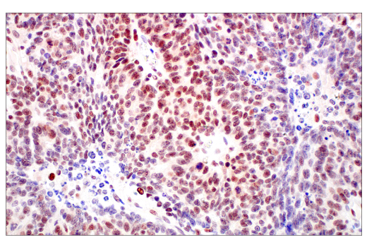 Immunohistochemistry Image 2: MLH1 (ES05) Mouse mAb