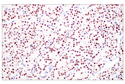 Immunohistochemistry Image 6: MLH1 (ES05) Mouse mAb