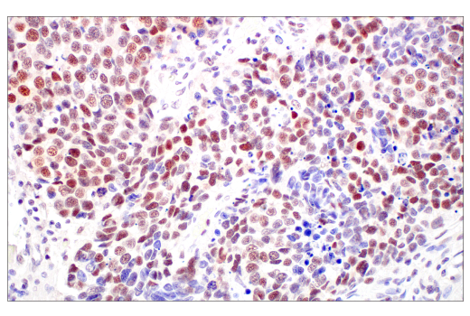 Immunohistochemistry Image 3: MLH1 (ES05) Mouse mAb