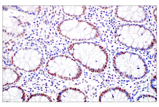 Immunohistochemistry Image 5: MLH1 (ES05) Mouse mAb