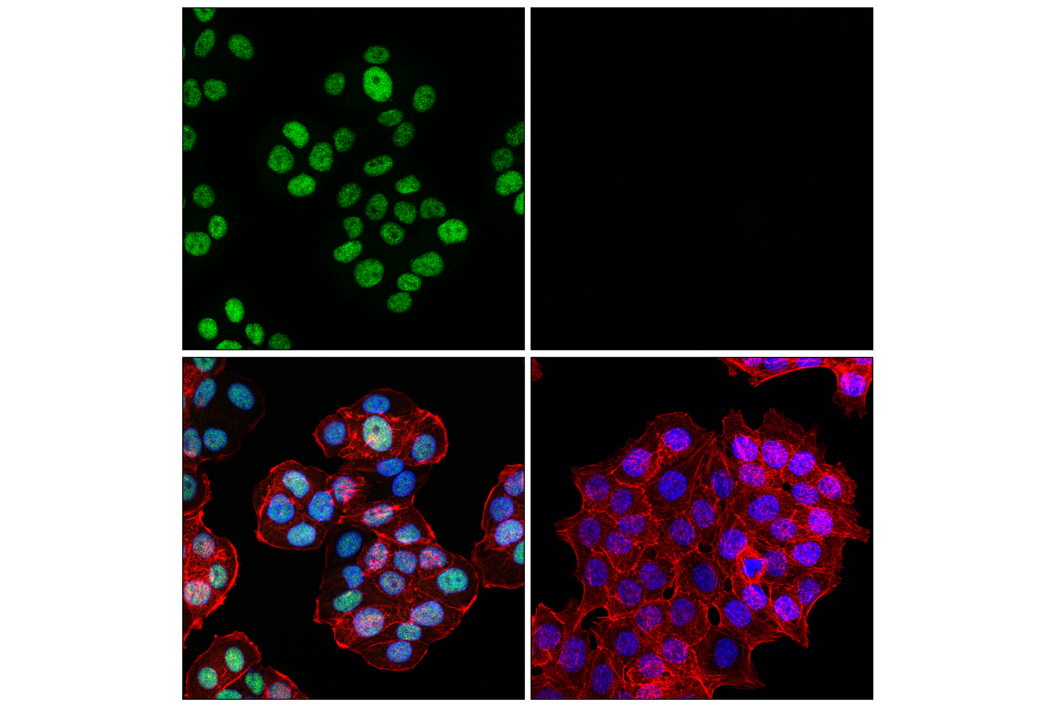Immunofluorescence Image 1: MLH1 (ES05) Mouse mAb