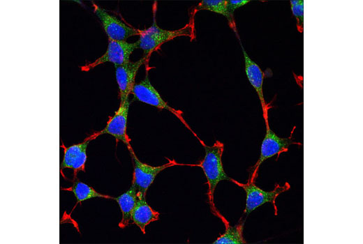Immunofluorescence Image 1: Clathrin Heavy Chain (D3C6) XP® Rabbit mAb