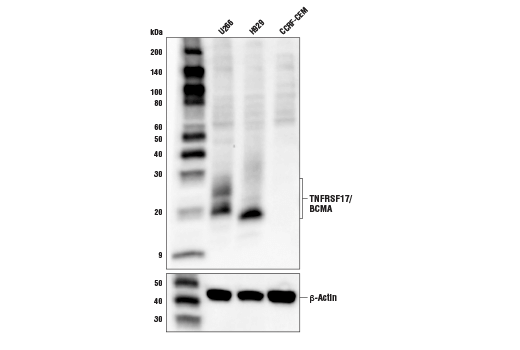 Western Blotting Image 1: TNFRSF17/BCMA Antibody