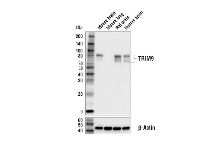Western Blotting Image 1: TRIM9 Antibody