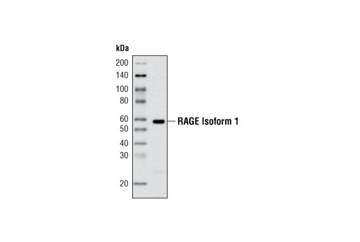 Western Blotting Image 1: RAGE 1 Antibody
