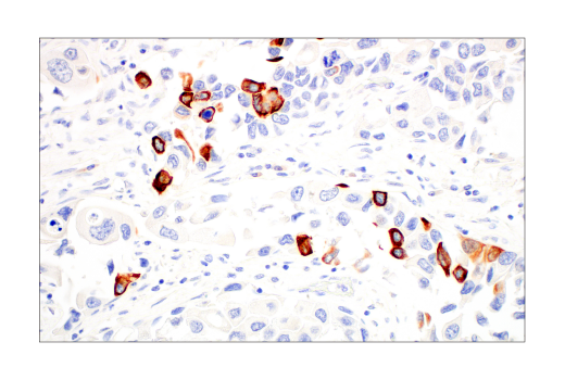 Immunohistochemistry Image 1: Keratin 14 (LL002) Mouse mAb