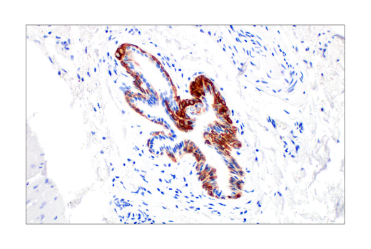 Immunohistochemistry Image 4: Keratin 14 (LL002) Mouse mAb