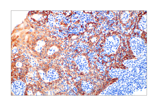 Immunohistochemistry Image 6: Keratin 14 (LL002) Mouse mAb