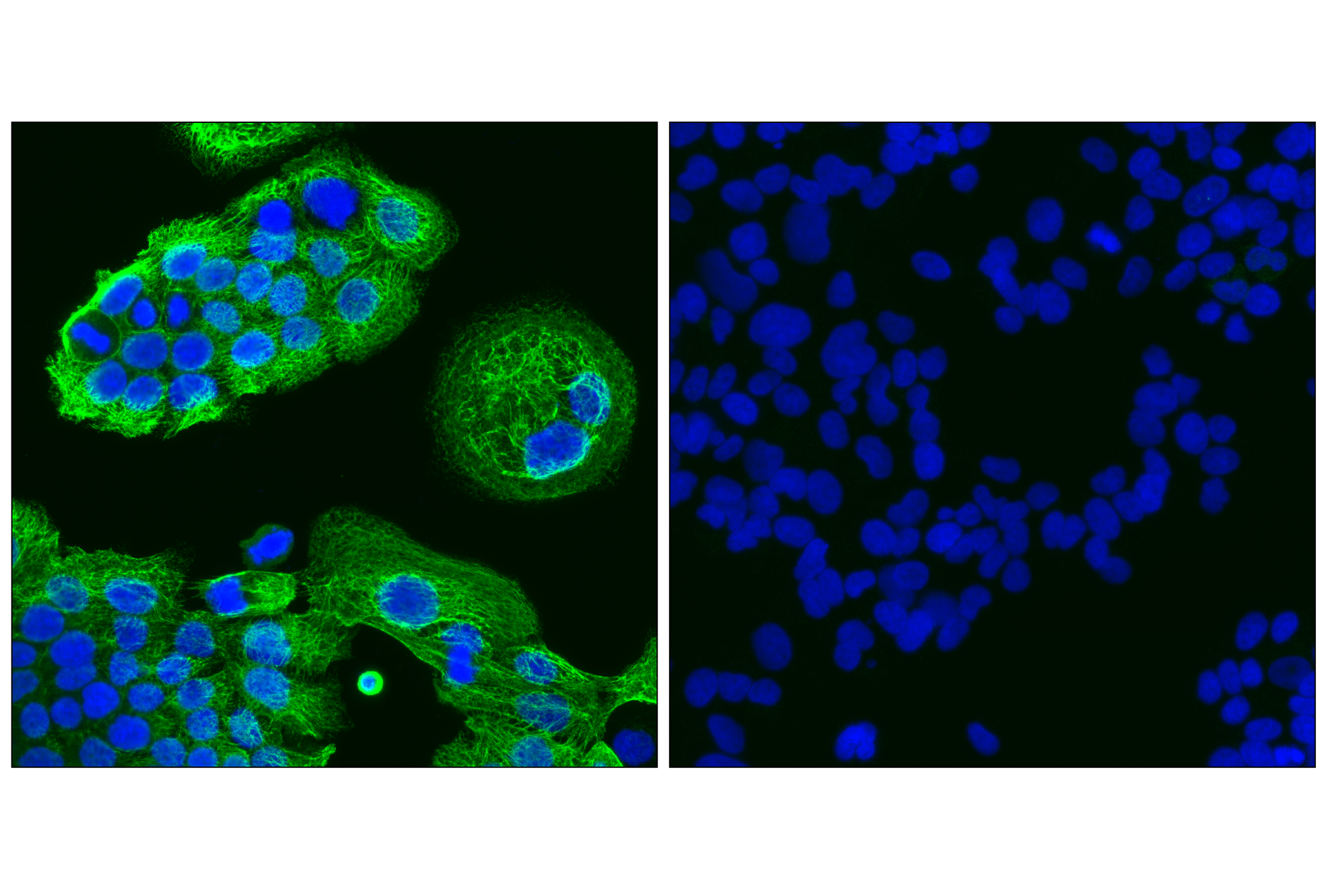 Immunofluorescence Image 1: Keratin 14 (LL002) Mouse mAb