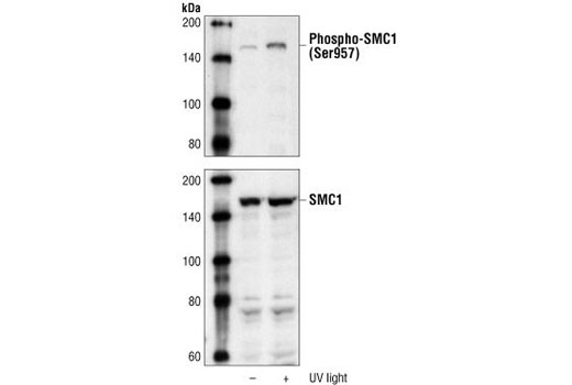 Western Blotting Image 1: SMC1 Antibody