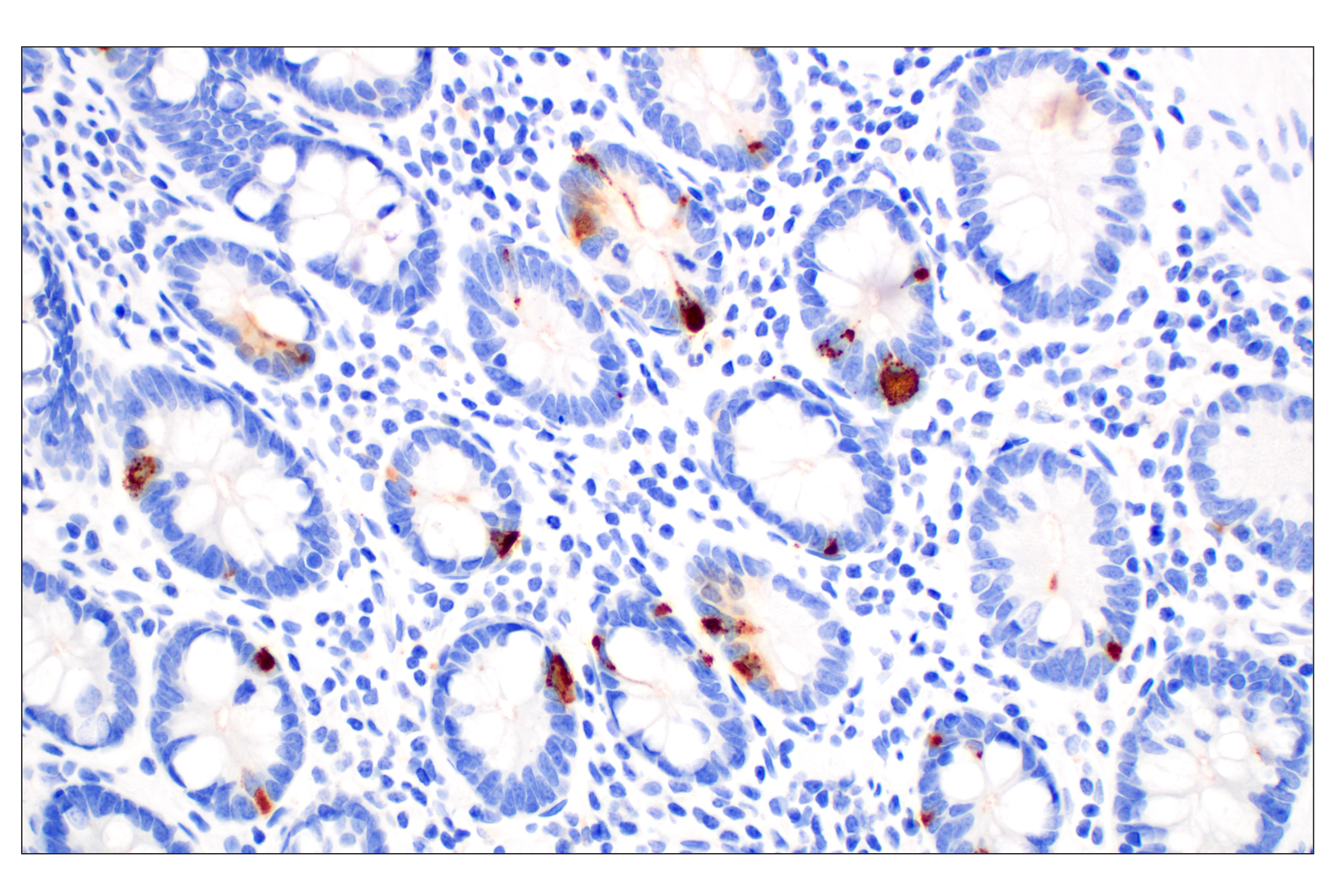 Immunohistochemistry Image 3: CHGA (F7D6H) Rabbit mAb (BSA and Azide Free)