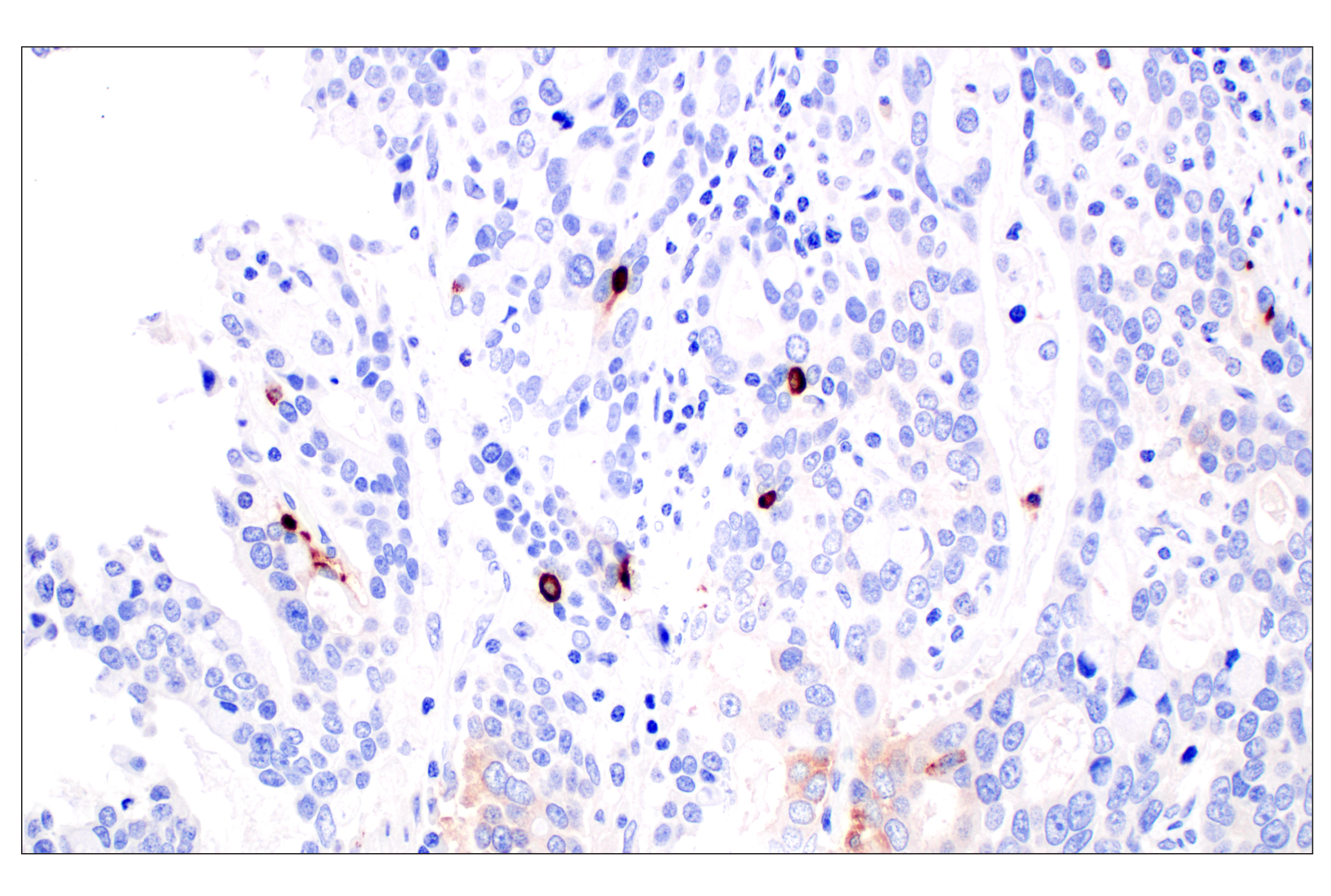Immunohistochemistry Image 6: CHGA (F7D6H) Rabbit mAb (BSA and Azide Free)