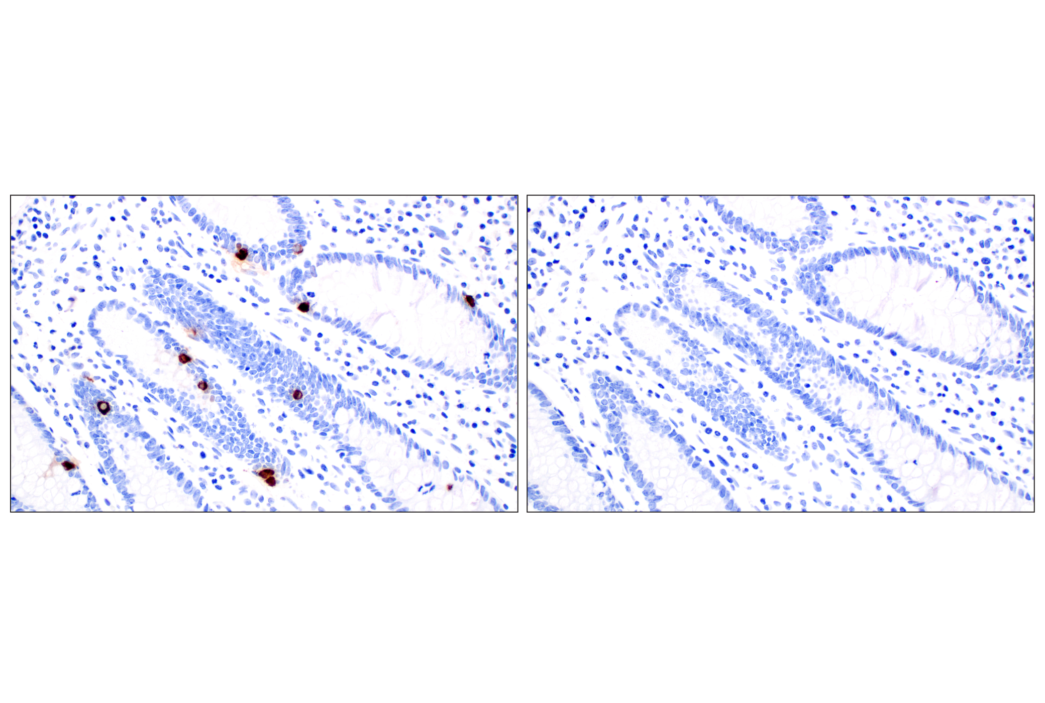 Immunohistochemistry Image 10: CHGA (F7D6H) Rabbit mAb (BSA and Azide Free)