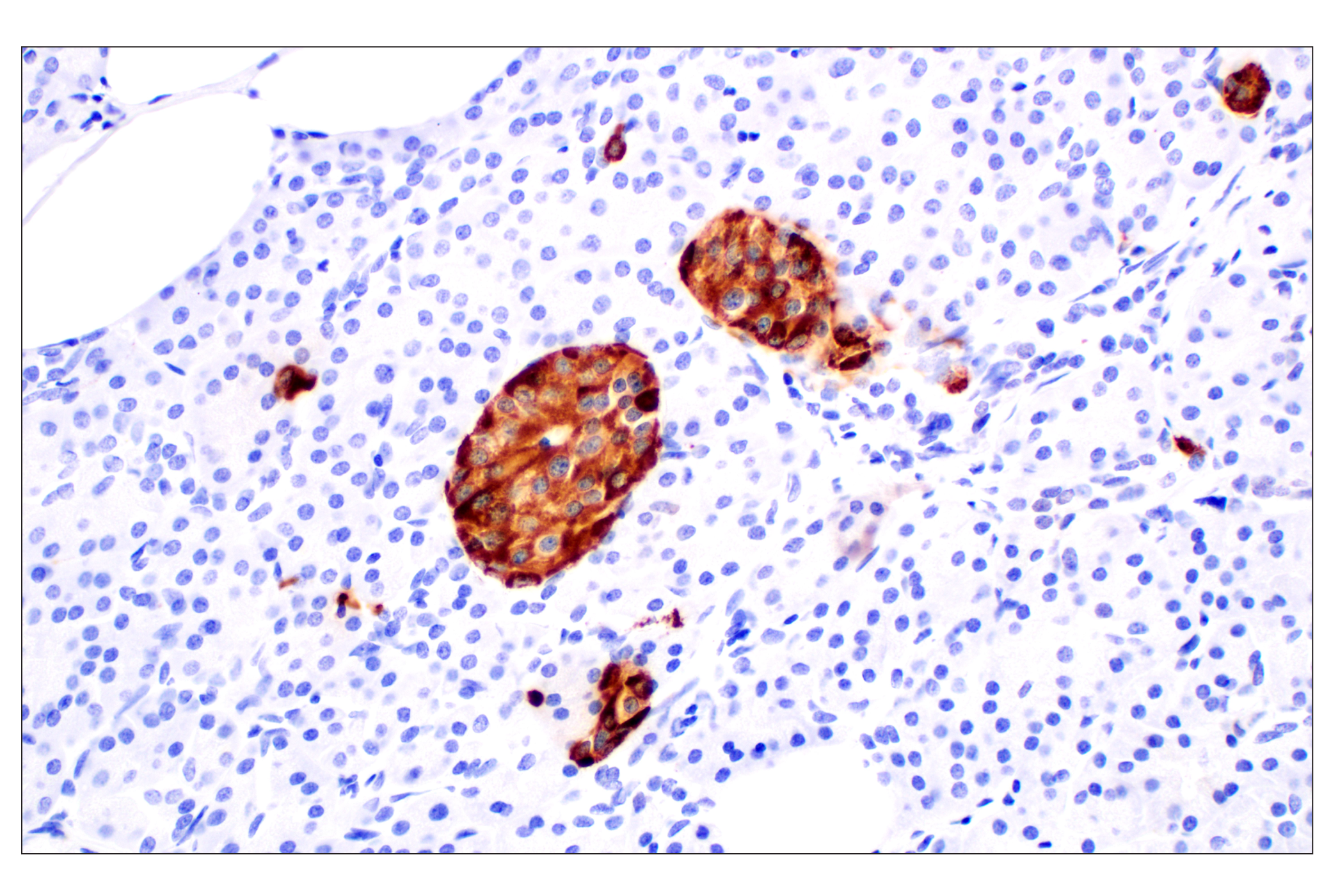 Immunohistochemistry Image 7: CHGA (F7D6H) Rabbit mAb (BSA and Azide Free)