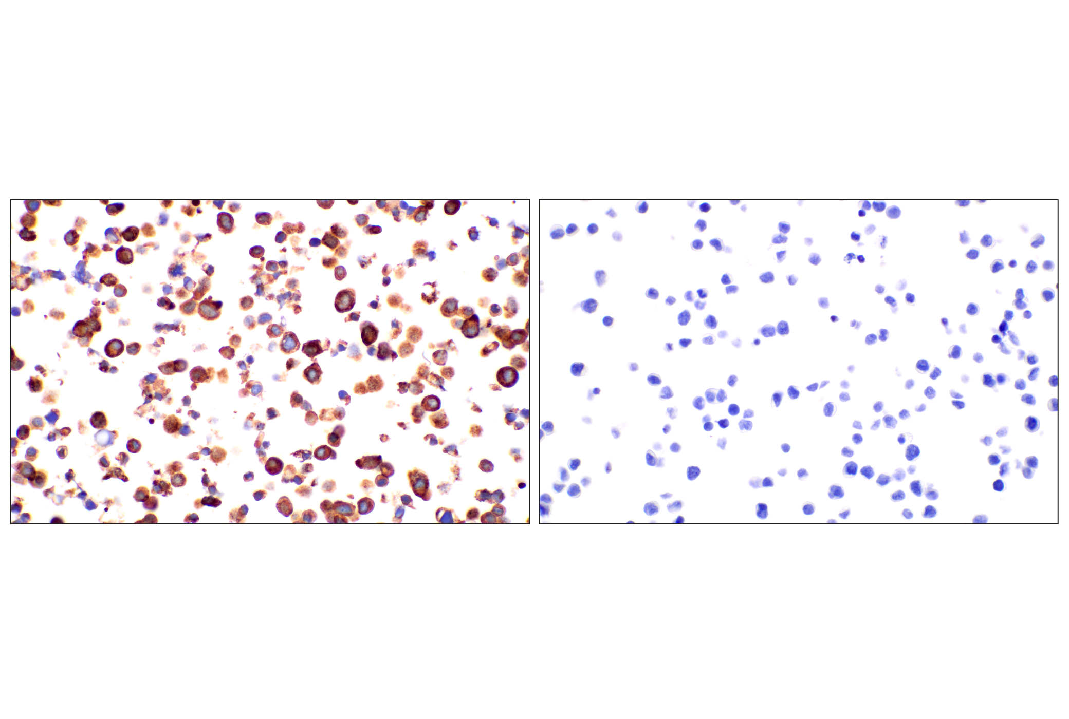 Immunohistochemistry Image 11: CHGA (F7D6H) Rabbit mAb (BSA and Azide Free)