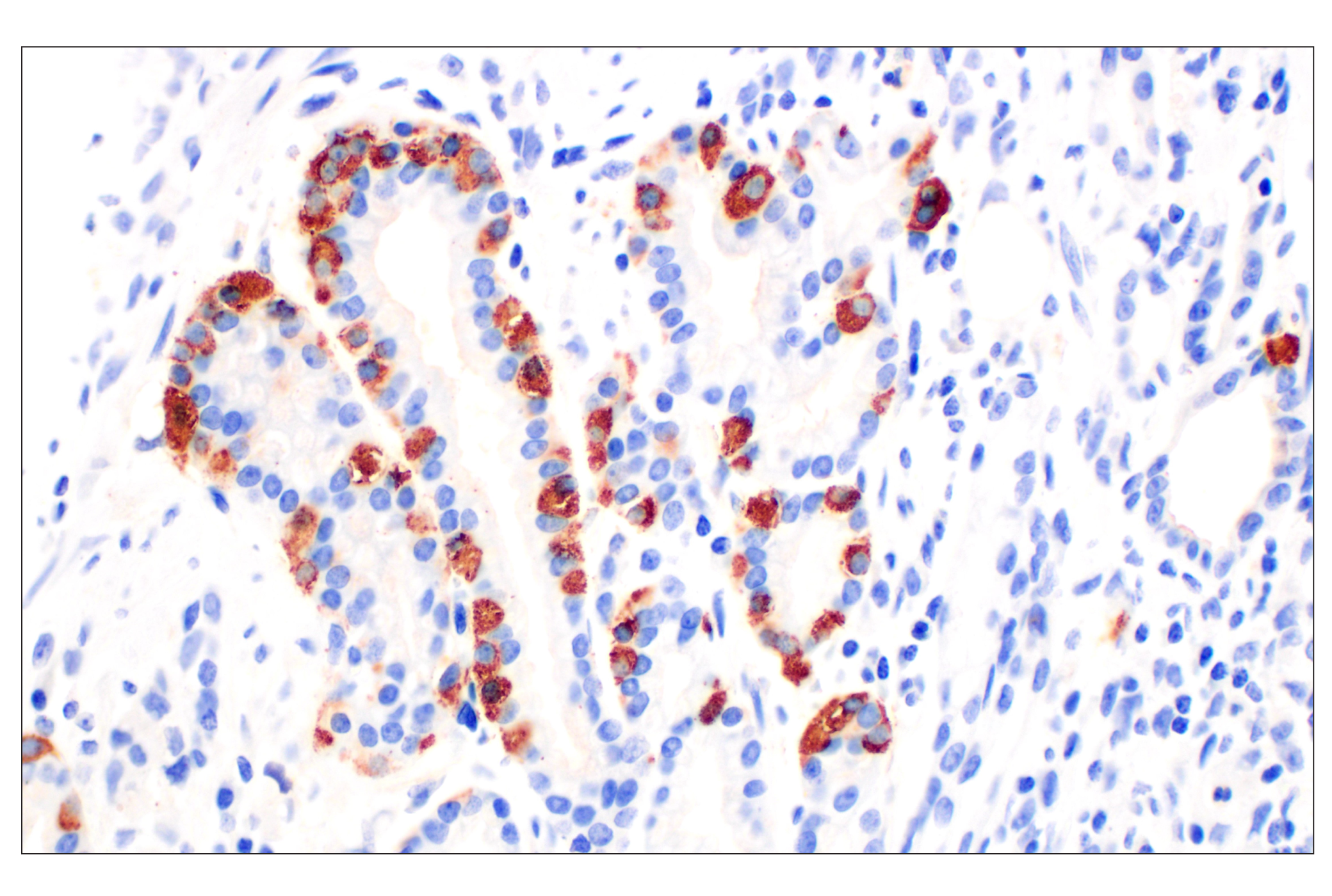 Immunohistochemistry Image 1: CHGA (F7D6H) Rabbit mAb (BSA and Azide Free)
