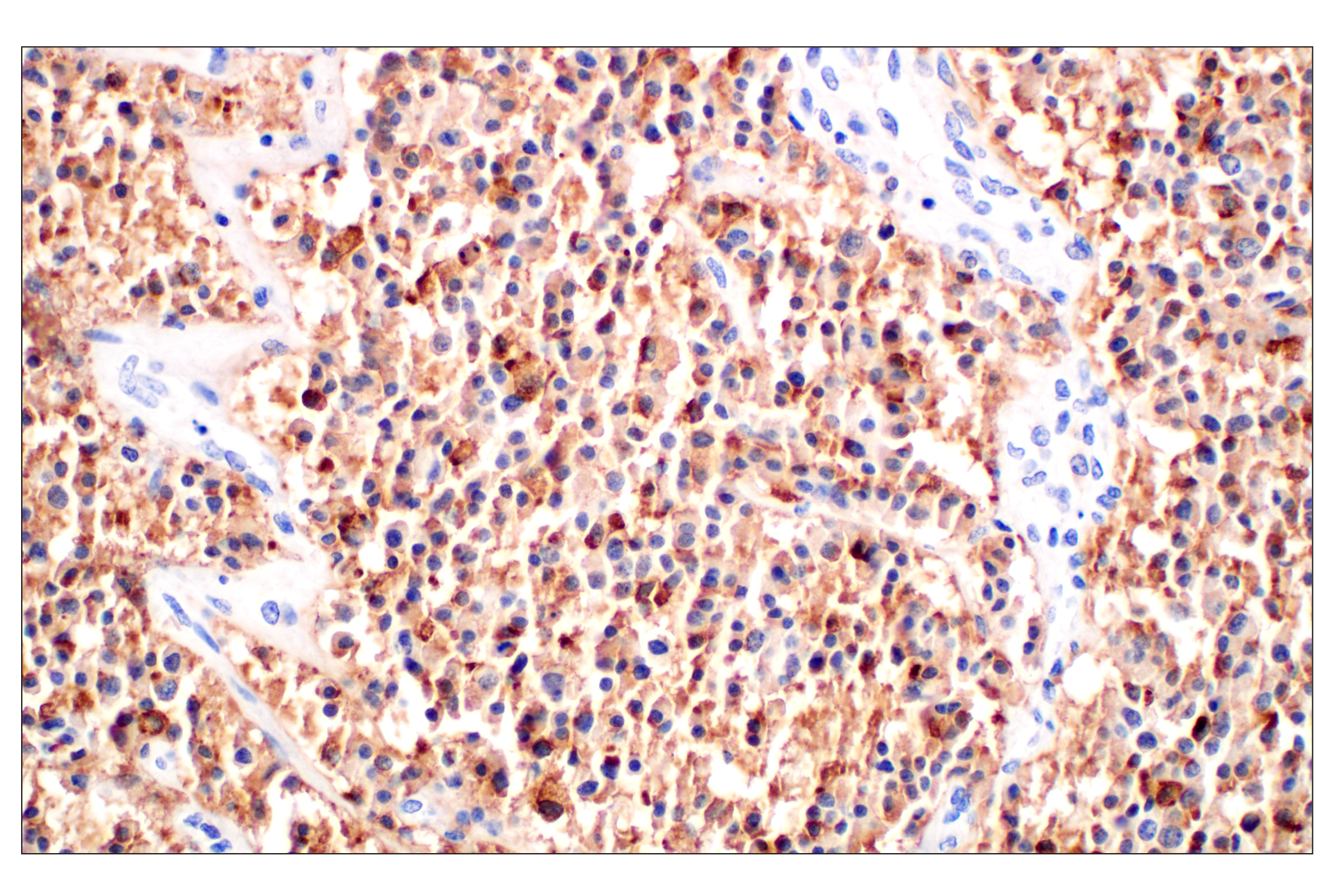 Immunohistochemistry Image 4: CHGA (F7D6H) Rabbit mAb (BSA and Azide Free)