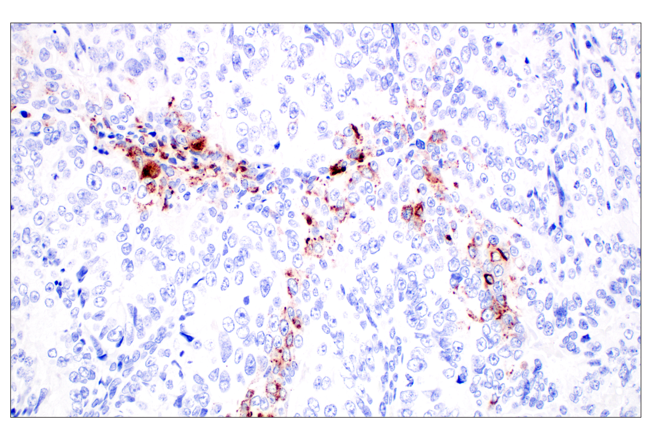 Immunohistochemistry Image 5: CHGA (F7D6H) Rabbit mAb (BSA and Azide Free)