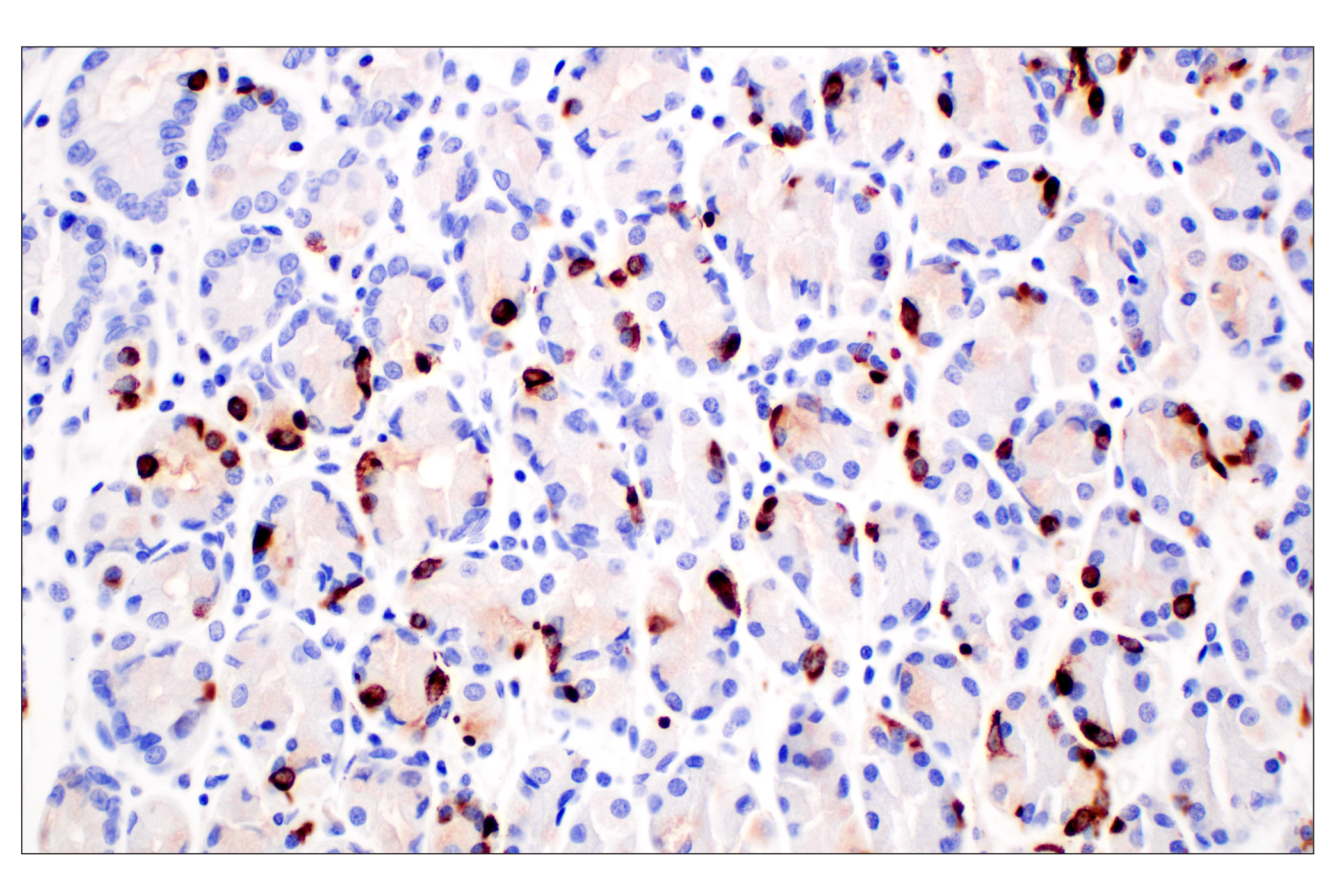 Immunohistochemistry Image 8: CHGA (F7D6H) Rabbit mAb (BSA and Azide Free)